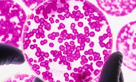 Stem cells being grown in a petri dish, which may revolutionise heart treatment.