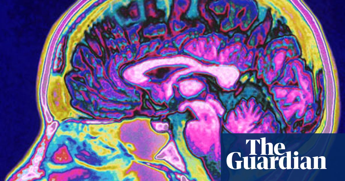 Visual Test To Quickly Check Brain >> Cortical Colouring In What Does Your Brain Do With Black And White Visual Test To Quickly Check Brain >> Cortical Colouring In What Does Your Brain Do With Black And White