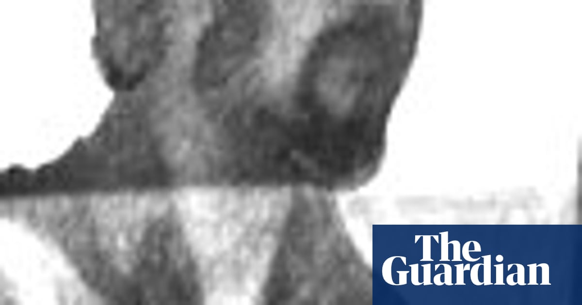 Yorkshire Ripper Stabbed In Face Uk News The Guardian