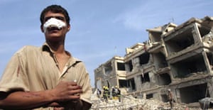 An injured man stands in front a building destroyed by of two suicide car bombs targeting a hotel used by foreigners in Baghdad. Photograph: Thaier al-Sudani/Reuters