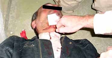 An image screened on the Australian TV station SBS of purported torture at Abu Ghraib