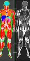 Are you a Tofi? (That's thin on the outside, fat inside) | Science | The Guardian Are you a Tofi? (That's thin on the outside, fat inside) | Science | The Guardian