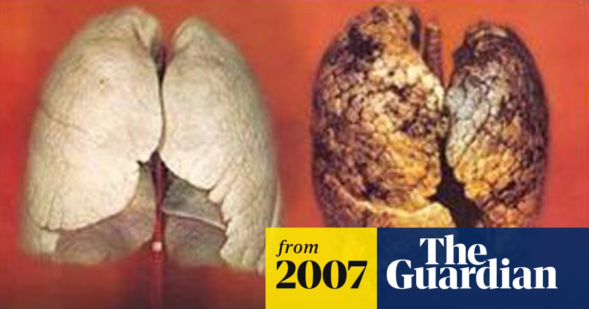 sore throat from cigarettes How Smoking Affects Your Throat and Voice Box? - sore throat from cigarettes How Smoking Affects Your Throat and Voice Box? -