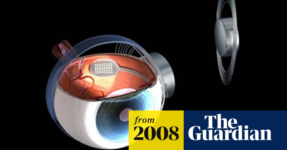Bionic Eye Gives Blind People Some Sight Medical Research The Guardian