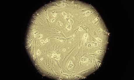 Embryonic stem cells are pictured through a microscope viewfinder in a laboratory
