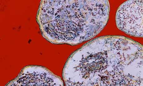 Bacteria Chlamydia trachomatis