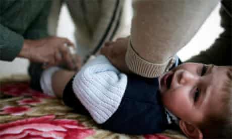 Infant Male Circumcision Is Genital Mutilation Reproduction The Guardian Infant Male Circumcision Is Genital Mutilation Reproduction The Guardian