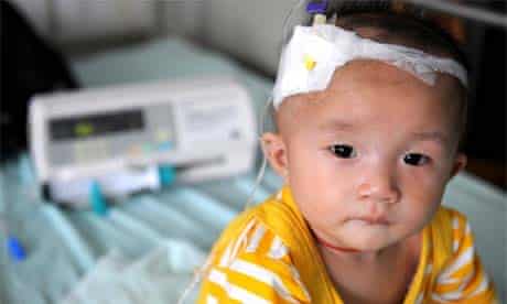 A baby who suffers from kidney stones after drinking tainted milk powder, Chengdu, China. September 22, 2008