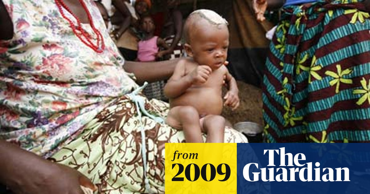 Women in developing countries 300 times more likely to die in