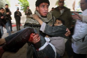 Gallery gaza conflict: Palestinians carry a boy, injured during an Israeli army operation in Gaza