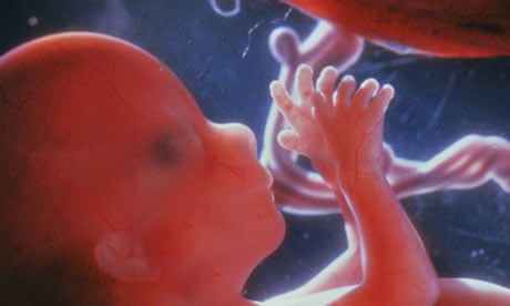 Scientists prove cancer can be passed on in the womb | Cancer research | The Guardian