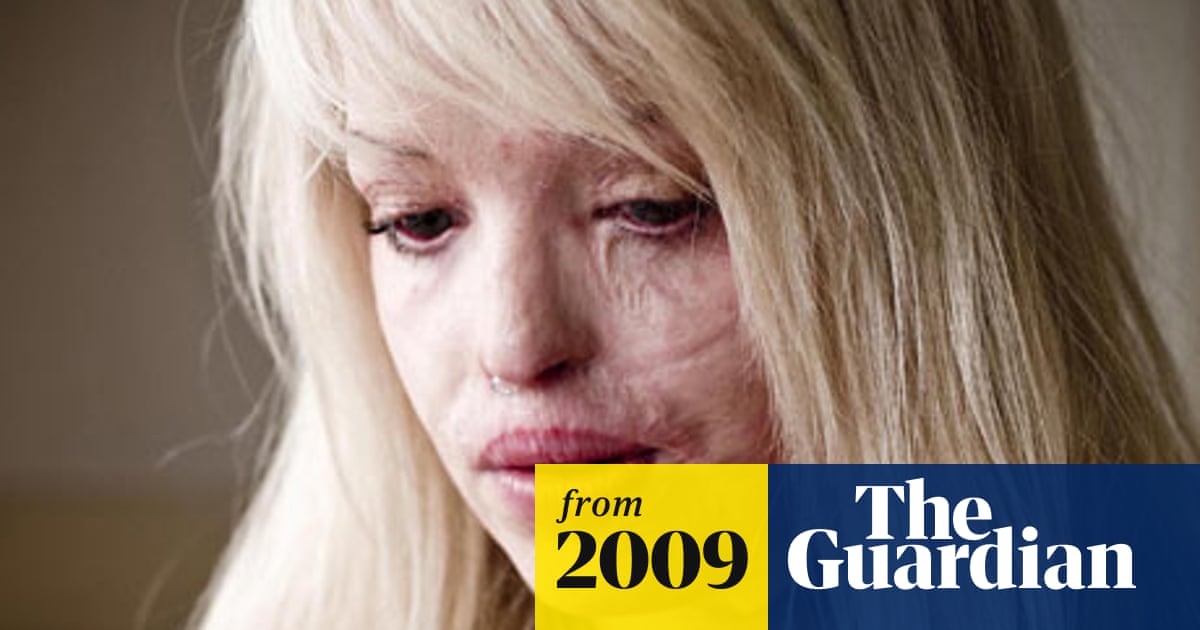 Acid attack survivor to deliver Channel 4's alternative Christmas ... Image Duterte image beautiful image beautiful image beautiful image beautiful image beautiful image beautiful image beautiful - Acid attack survivor to deliver Channel 4's alternative Christmas ...