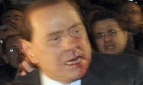 Italy's prime minister Silvio Berlusconi leaves Duomo's square with blood on his face