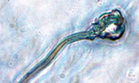 A microscope image of IVD sperm