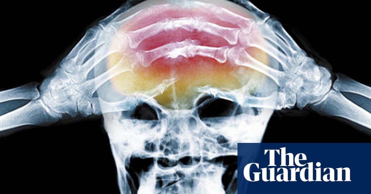 Where S Your Headache At Health Wellbeing The Guardian Where S Your Headache At Health Wellbeing The Guardian