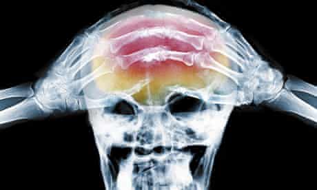 Where S Your Headache At Health Wellbeing The Guardian Where S Your Headache At Health Wellbeing The Guardian