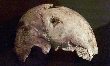 Fragment of Adolf Hitler's skull