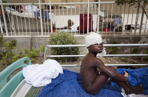 David Levene in Haiti: George Hami, 7, is treated at the Jean Damien children's hospital