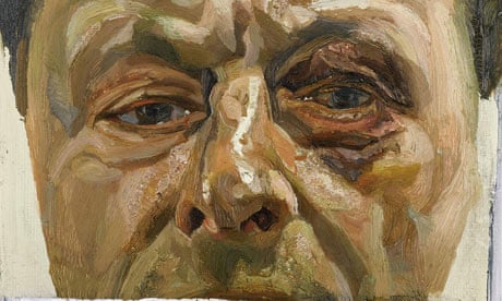 Detail from Lucian Freud's Self-Portrait With a Black Eye