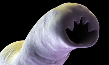 Electron micrograph of an intestinal hookworm