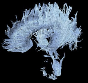 Portraits of the mind: diffusion MRI image