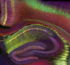 Portraits of the mind: Photomicrograph of a mouse hippocampus
