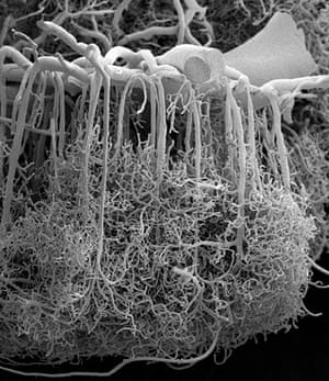 Portraits of the mind: Photomicrograph of microscopic blood vessels