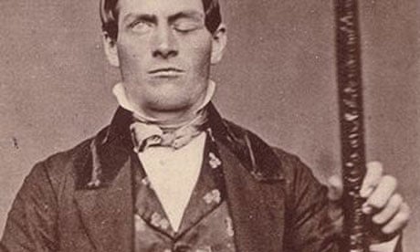 Phineas Gage with the tamping rod that was driven through his head