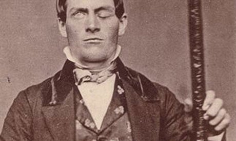 case study of phineas gage psychology Phineas Gage with the tamping rod that was driven through his head