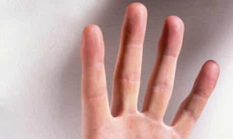 Finger prostata ​Screening for