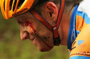 TDF Crashes: Vande Velde injured whilst riding in Stage Two