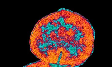 Pass notes, No 2,836: Gonorrhea | Health | The Guardian