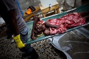 Haiti one year on: November 13: An elderly woman suffering cholera symptoms on a stretcher