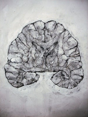 Brainstorm: Investigating the brain through art and science