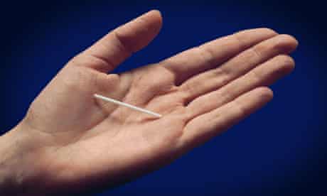 Hundreds Become Pregnant Despite Contraceptive Implant Implanon Pregnancy The Guardian