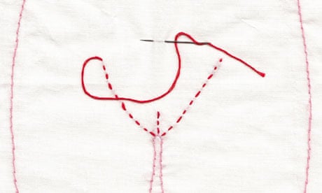 460px x 276px - Designer vagina surgery: snip, stitch, kerching! | Life and style | The  Guardian
