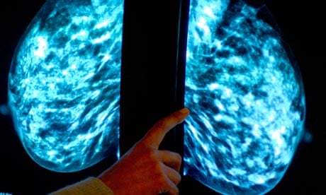A mammogram to check for breast cancer