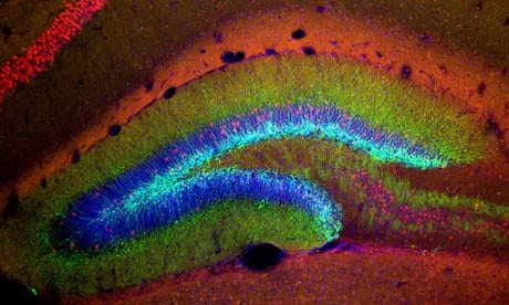 The hippocampus of a young mouse