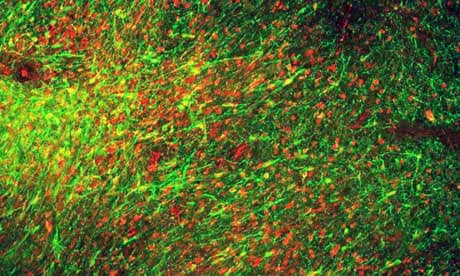 Human dopamine nerve cells made from stem cells