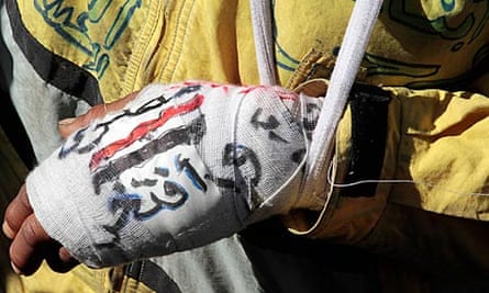 A Tahrir Square protester's bandaged hand