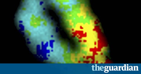 Wellcome Image Awards 2011: Life as you've never seen it before - in