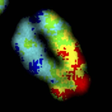Wellcome Image Awards: Human chromosome lifetime Map