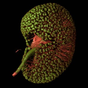 Wellcome Image Awards: 3D model of the developing mouse kidney