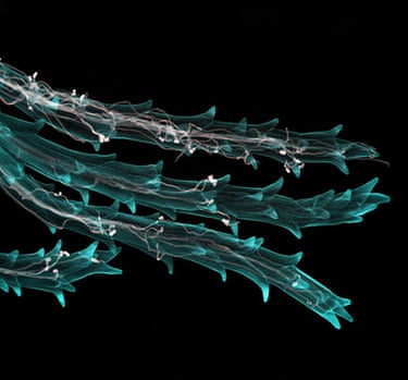 Wellcome Image Awards: Ergot fungus infection in wheat