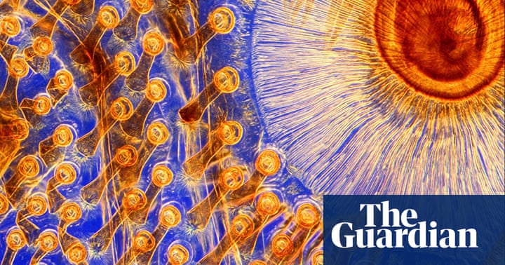 Wellcome Image Awards 2011: Life as you've never seen it