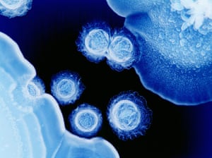 Wellcome Image Awards: Peridontal bacteria