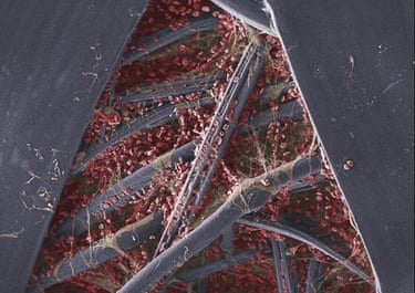 Wellcome Image Awards: Clotting blood on sticking plaster