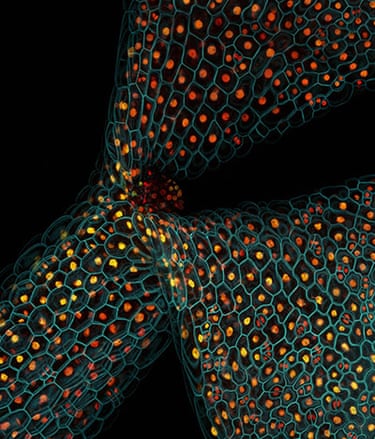 Wellcome Image Awards: Cell division and gene expression in plan