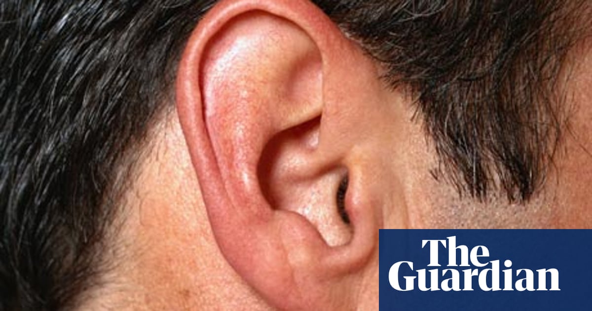 Cleaning of external auditory canal adult- Ear wax cleaning electronic- Ear wax