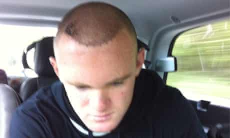 Wayne Rooney's hair transplant tweet 6/6/11